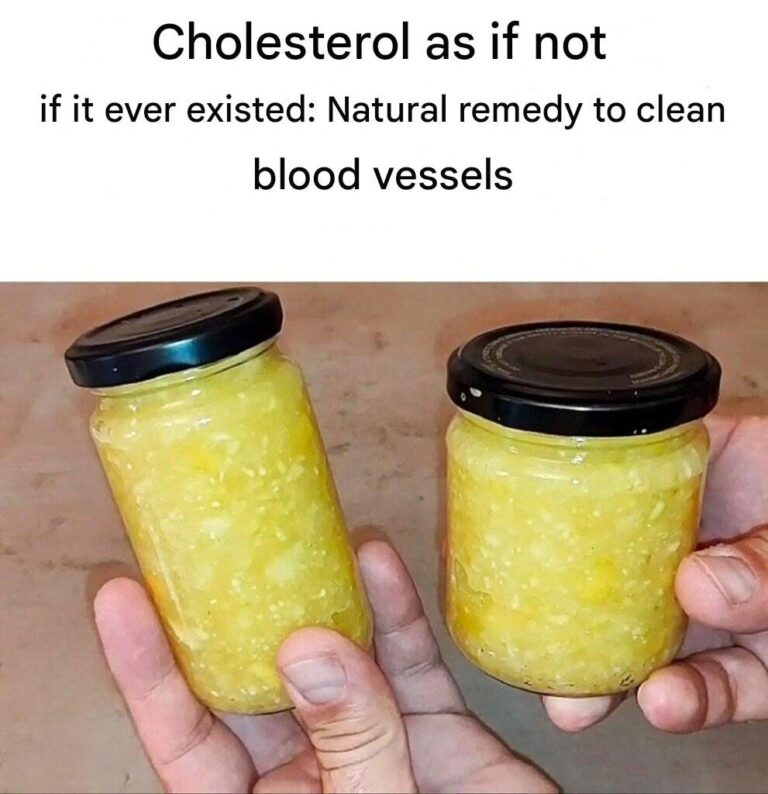 Cholesterol as if it never existed: A natural remedy to clean bl00d vessels.