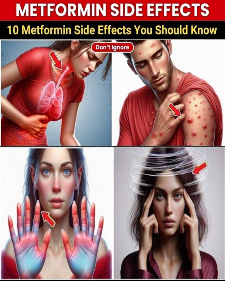 The 10 Metformin Side Effects Your Doctor Hopes You Discuss – What Many Experience But Few Report!