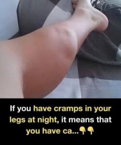 If You Have Cramps in Your Legs at Night, It Means Your Body Is Sending a Signal—Here’s What to Do