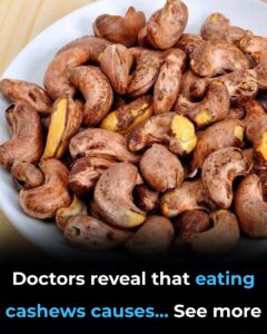Doctors Reveal That Eating Cashews Causes… (7 Science-Backed Benefits You’ll Love)