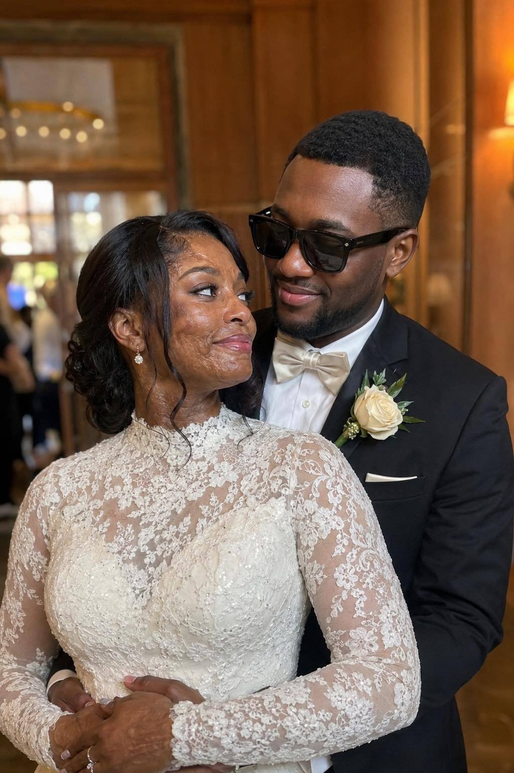 I Married a Blind Man So He’d Never See My Scars – On Our Wedding Night, He Said, ‘You Need to Know the Truth I’ve Been Hiding for 20 Years’